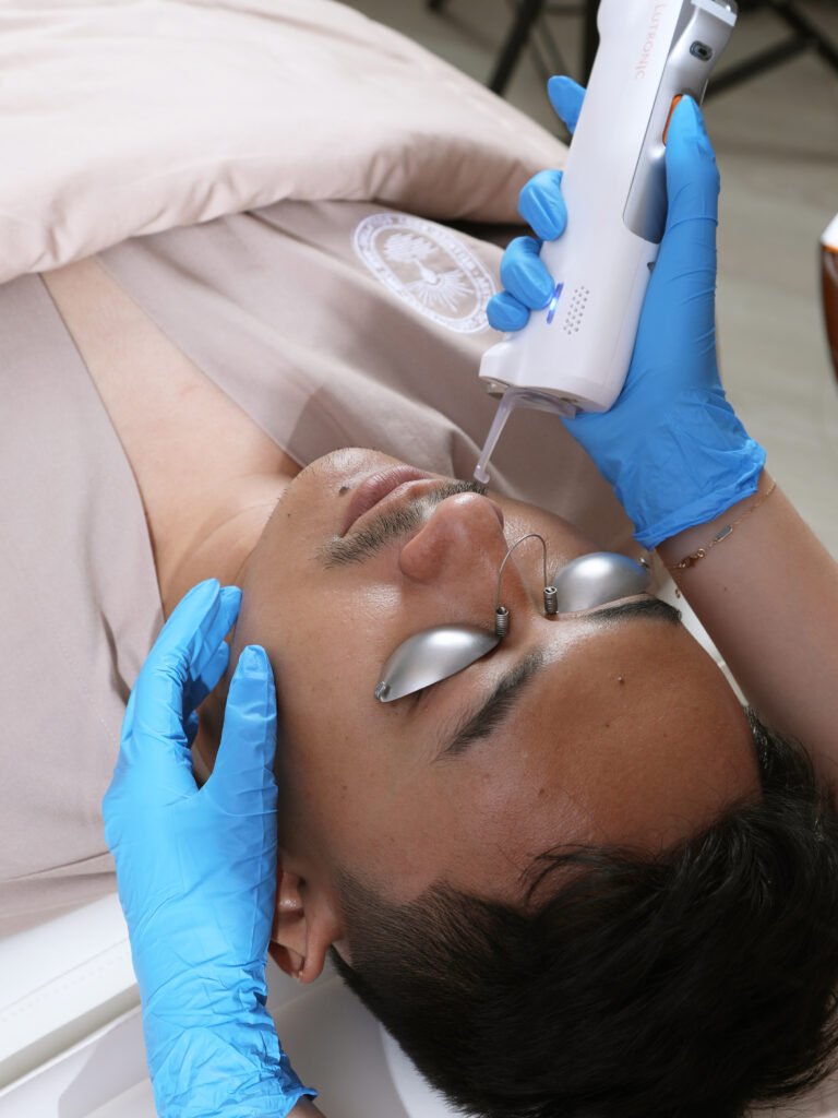 Laser Vaskular vs Pico: Mana yang Pas Buat Atasi Melasma?